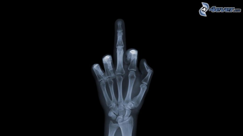 gest, zdjęcie rentgenowskie, ręka