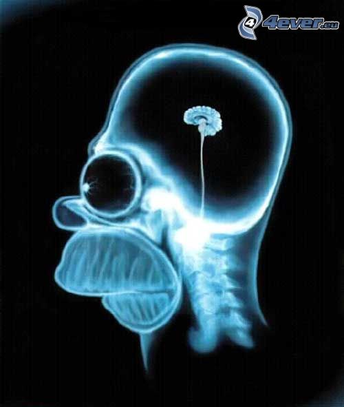 Homer Simpson, mózg, zdjęcie rentgenowskie