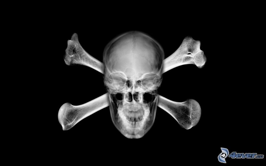 skeleton, X-ray, Bones